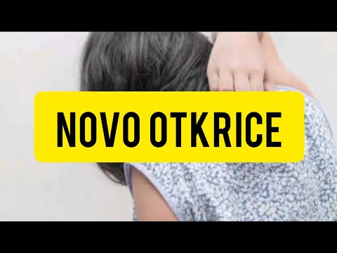 Video: Osip Na Koži Zbog Dodira S Mačama