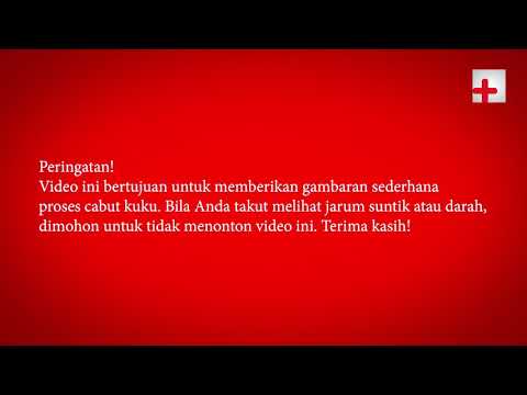 Cabut kuku biasanya dilakukan oleh dokter atau perawat UGD , menurut pengalaman pasien ketika dicabu. 