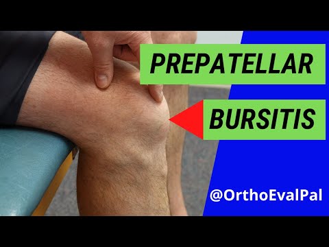 Video: Forsvinder præpatellar bursitis?