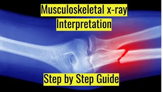 🤯 Musculoskeletal x ray interpretation, Complete step by step guide. screenshot 3