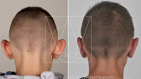 Facial Plastic Surgery For Men  Seattle Washington...