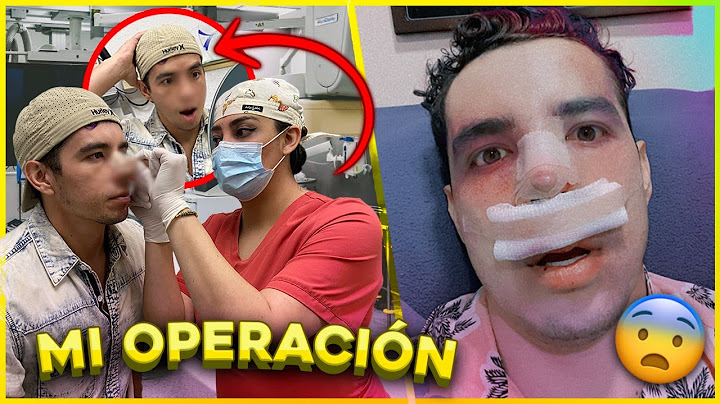 ME OPERÉ LA NARIZ Y.. NO ME GUSTO EL RESULTADO? 😰 | MAU MC MAHON