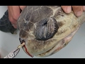 Turtle saved by pulling out drinking straw in its nostril