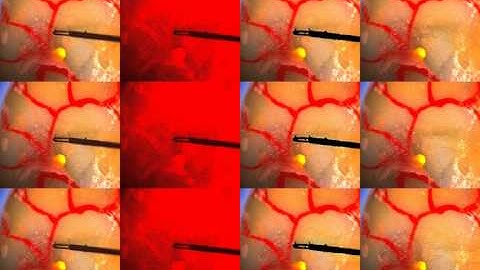 Adaptive Illumination Scheme for Retinal Microsurgery