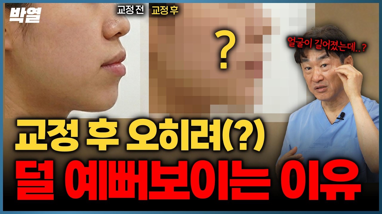 치아 교정하면 다 예뻐지는 거 아니였냐고요..