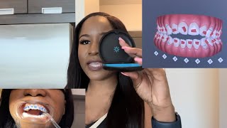 Invisalign Journey, 10 months to a perfect smile! Open and cross bite correction screenshot 2