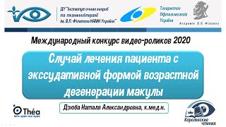 Случай лечения пациента с экссудативной формой возрастной дегенерации макулы