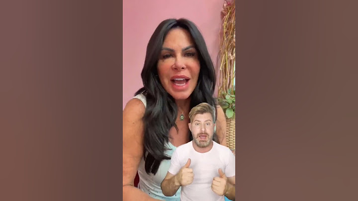 Queda de cabelo da Gretchen - Ela optou por utilizar a prótese capilar