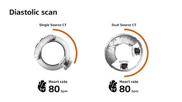 Dual Source CT in Cardiac Imaging: Ready beyond tomorrow