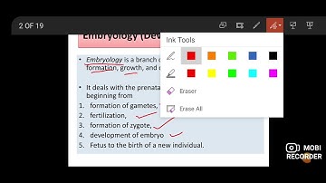B  Sc  III Sem VI Paper XIII Developmental Biology   Types Of Egg in vertebrates