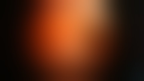 Cholangiocarcinoma - Bismuth Type II