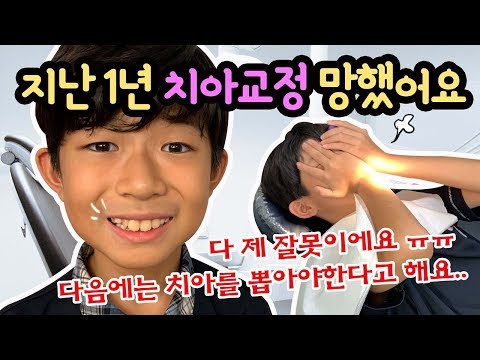 어떡해요 ㅠㅠ 마이린 1년동안 치아교정 망했어요 (여러분 치아교정 이렇게 하면 안 되요)  새학기 치아교정 과정 밀착 중계 | 마이린 TV