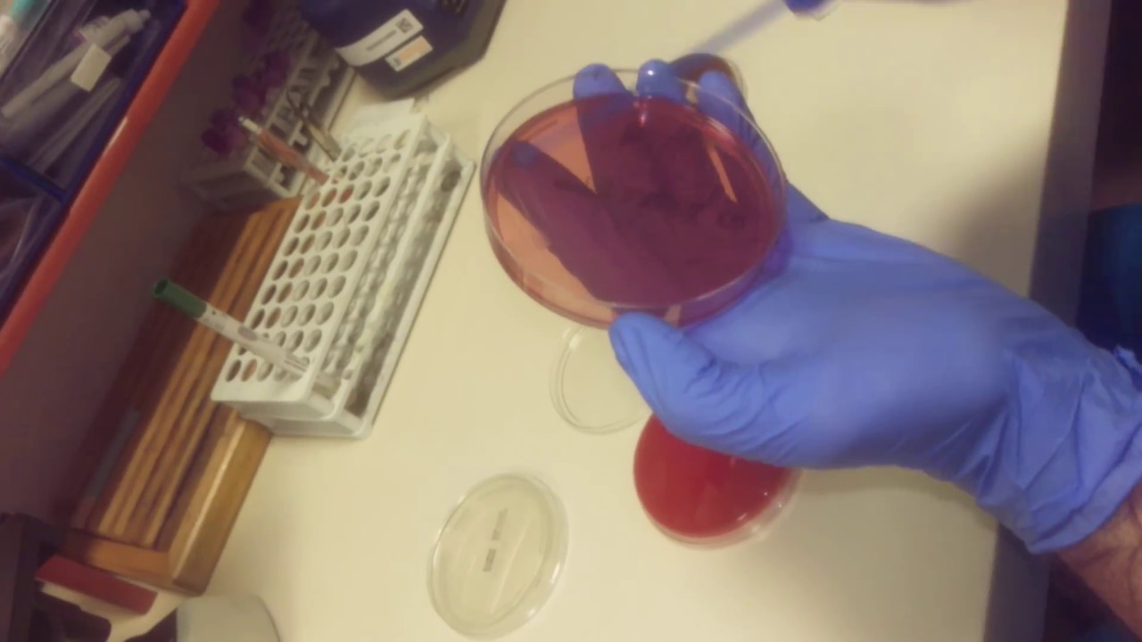 Vajen Kültürü Ekim Yöntemi