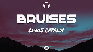 Lyrics 🎧: Lewis Capaldi - Bruises