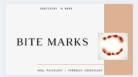 BITE MARKS