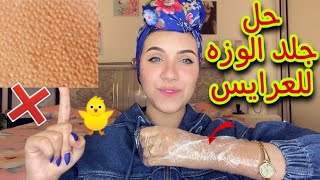 علاج جلد الوزة ب ٩ جنية فقط في اسبوعين بس للعرايس 😍 نتيجه من أول استعمال