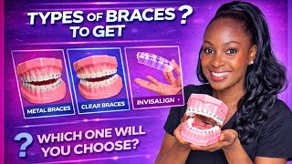 Getting braces? Watch this first!  #braces #braceson