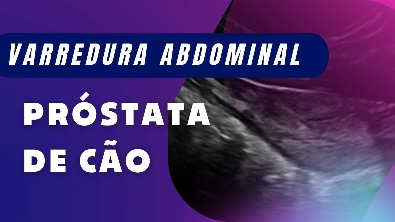 aiom k próstata