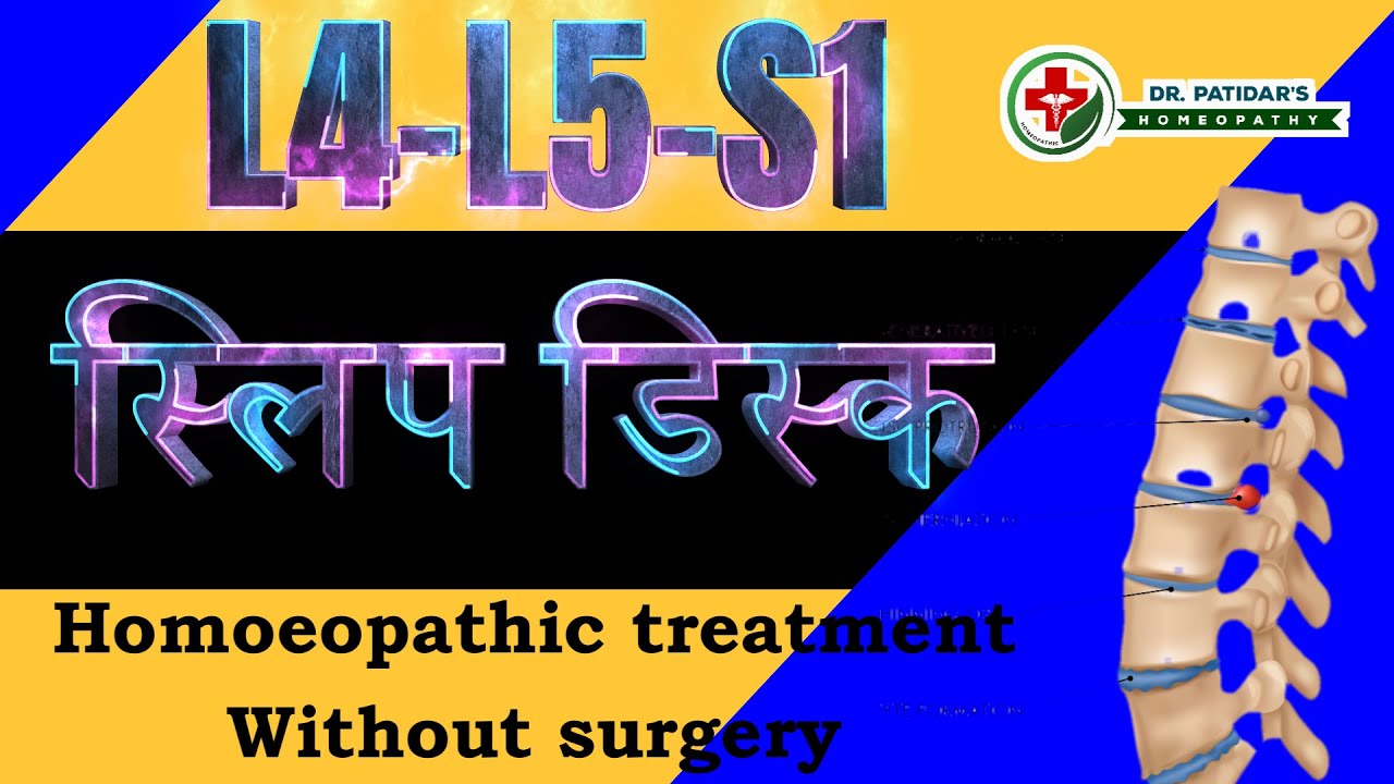 Slip Disc treatment without surgery Homeopathic treatment for slipped disc/Disc herniation/L4