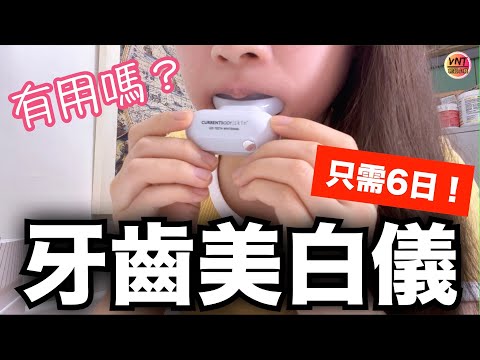 親身試用🦷牙齒美白機，只需6天，效果係點？VNT輕鬆小棧