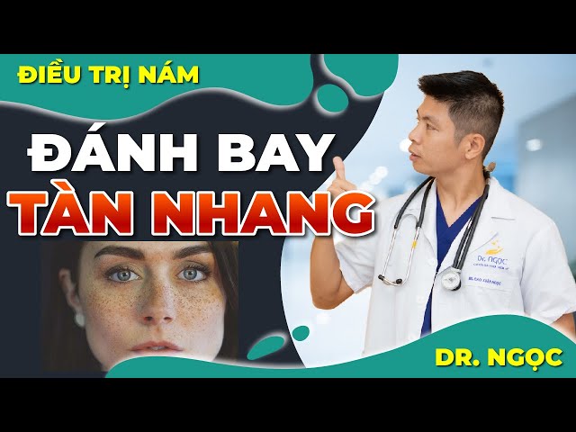 Làm cách nào để điều trị khỏi tàn nhang- Dr Ngọc