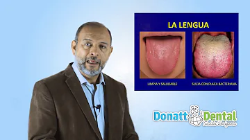 ¿Cómo se limpia una lengua maloliente?