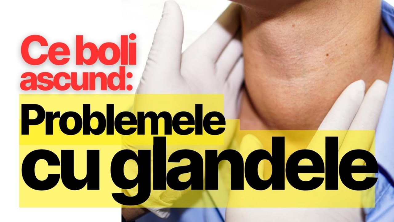 Ce boli ascund Problemele cu GLANDELE