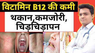 थकान,कमजोरी,घबराहट,विटामिन B12 की कमी के लक्षण | B12 Deficiency Symptoms & Cause Treatment - Hindi