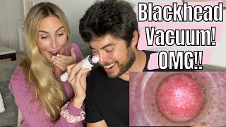 OMG!!! Testing a Blackhead Vacuum with Microscope Camera on my Husband!!