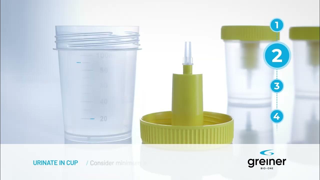 Urine Cup Handling (EN) YouTube