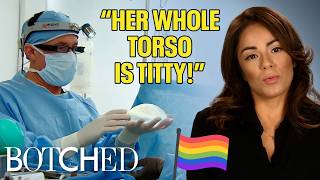 Leslie's Whole Torso is Titty According to Her Girlfriend (Before & After) | Botched | E!