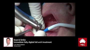 All matrix® Apps in 1 Case: "Scan & Smile - Immediate Fully Digital Full Arch Treatment"