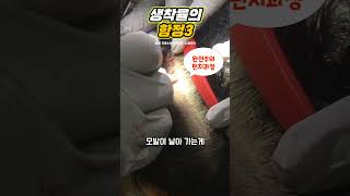 모발이식 생착률의 함정 #모발이식 #생착률 #모발이식결과