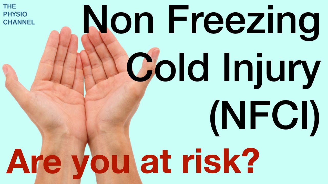 Non Freezing Cold Injury NFCI Explained Are You At Risk YouTube Non Freezing Cold Injury NFCI Explained Are You At Risk YouTube
