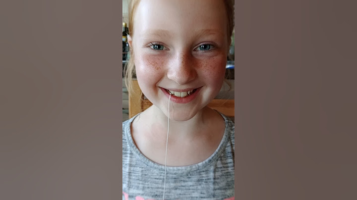Marie zieht sich ihren Zahn  Milchzahn #zahnfee #sommersprossen  #marita #milchzahn #toothfairy