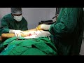Kaise Orthopedic Surgeons Implementation Karte Hai . 