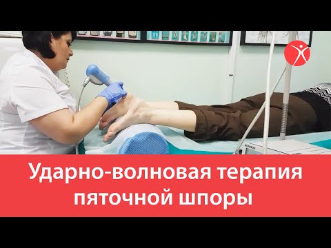 Лечение пяточной шпоры на аппарате ударно-волновой терапией