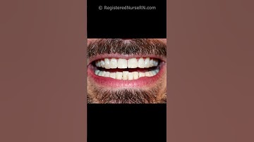 Clear Braces Before and After (Invisalign / 3M Clarity) Cost, Pictures, Orthodontic Treatment