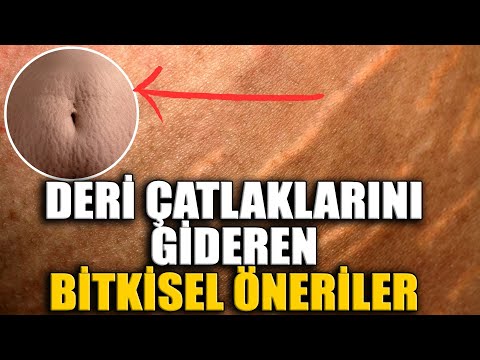 Cilt Deri çatlakları nasıl geçer? Çatlaklar için basit çözüm önerileri!