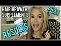 💝HOW TO GROW HAIR FAST | SUPPLEMENTS FOR HAIR GROWTH | BEFORE & AFTER PICS  💝