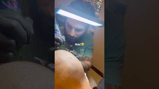 Scalp Micropigmentation NYC | No Surgery, No Meds Hair Loss Solution