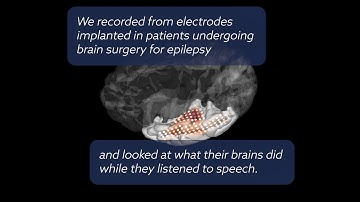 Parallel and distributed encoding of speech across human auditory cortex
