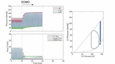 PV loop －ECPELLA－