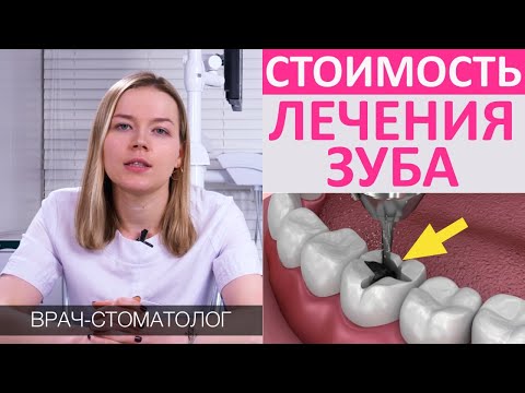 Сколько стоит вылечить зуб? Стоимость зубной пломбы, цена лечения кариеса, пульпита, каналов зуба