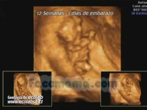 Embarazo 12 semanas 4 dias