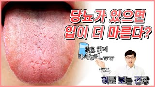 입냄새 입마름 혀통증, 당뇨가 있으면 더 심해진다구요?