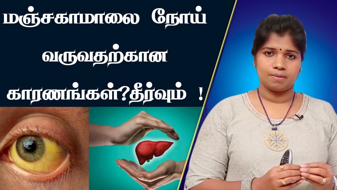 மஞ்சள் காமாலையின் அறிகுறிகள் | Jaundice Symptoms and Cure, Manjal Kamalai