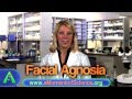 Facial agnosia  a moment of science  pbs