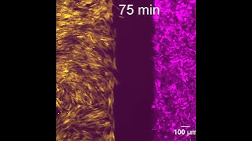 pnas_p53 aids cancer cell migration