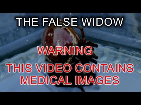 Video: Brown Widow Bite: Sintomi, Trattamento, Prevenzione, Immagini
